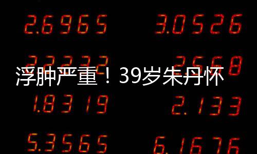 怀孕严重月 浮肿7个朱丹直播坚持9岁深夜带货